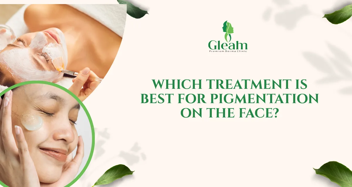 Which Treatment Is Best for Pigmentation on the Face