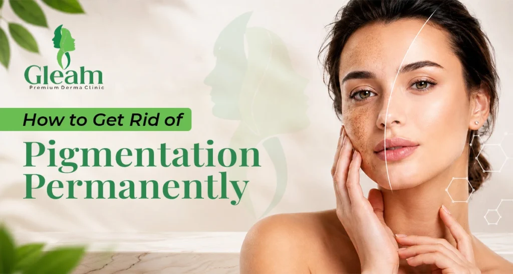How to Get Rid of Pigmentation Permanently